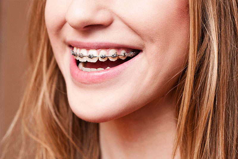 Orthodontics in Manchester