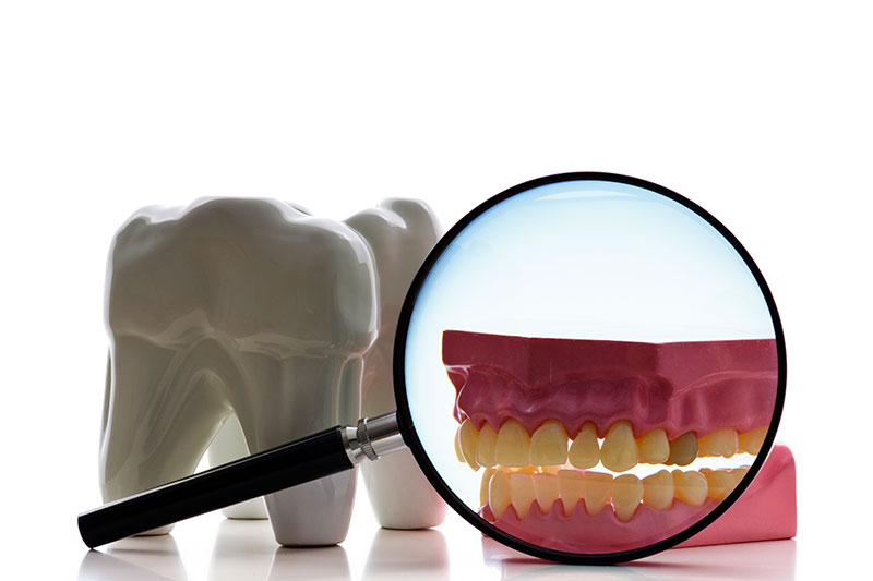 Root Canal Treatment in Manchester