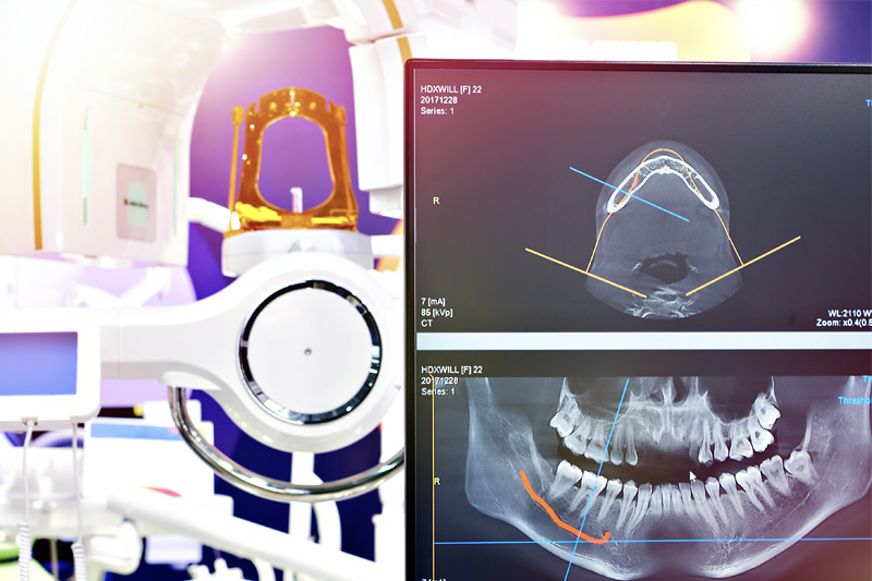Digital X-Rays in Manchester